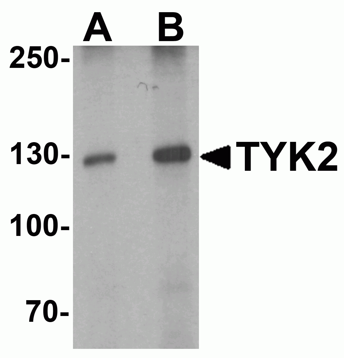 TYK2 Antibody
