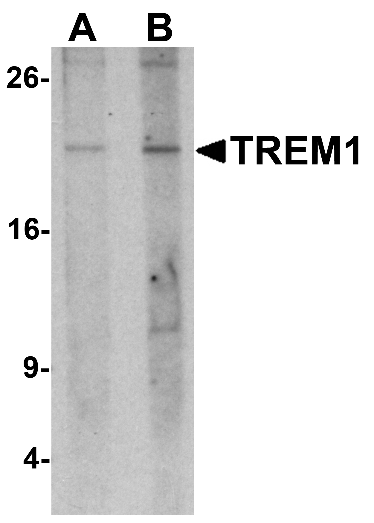 TREM1 Antibody
