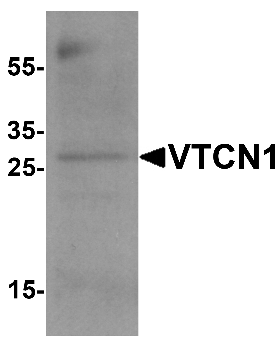 VTCN1 Antibody