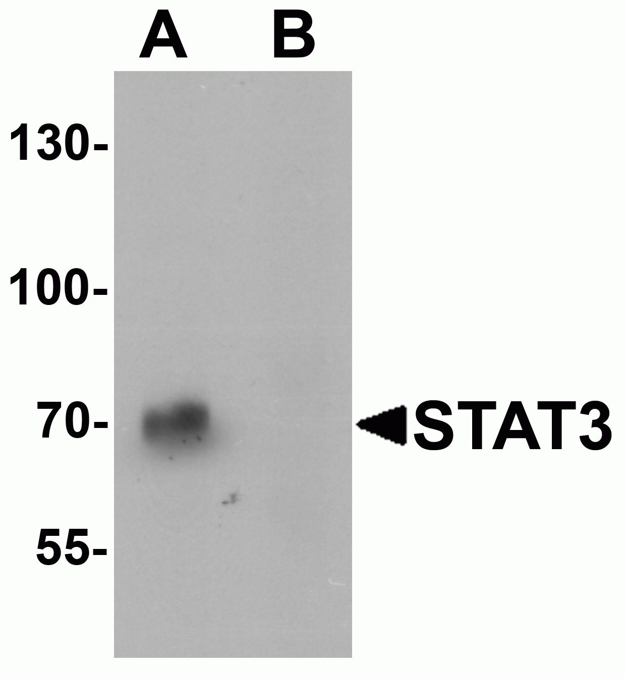 STAT3 Antibody