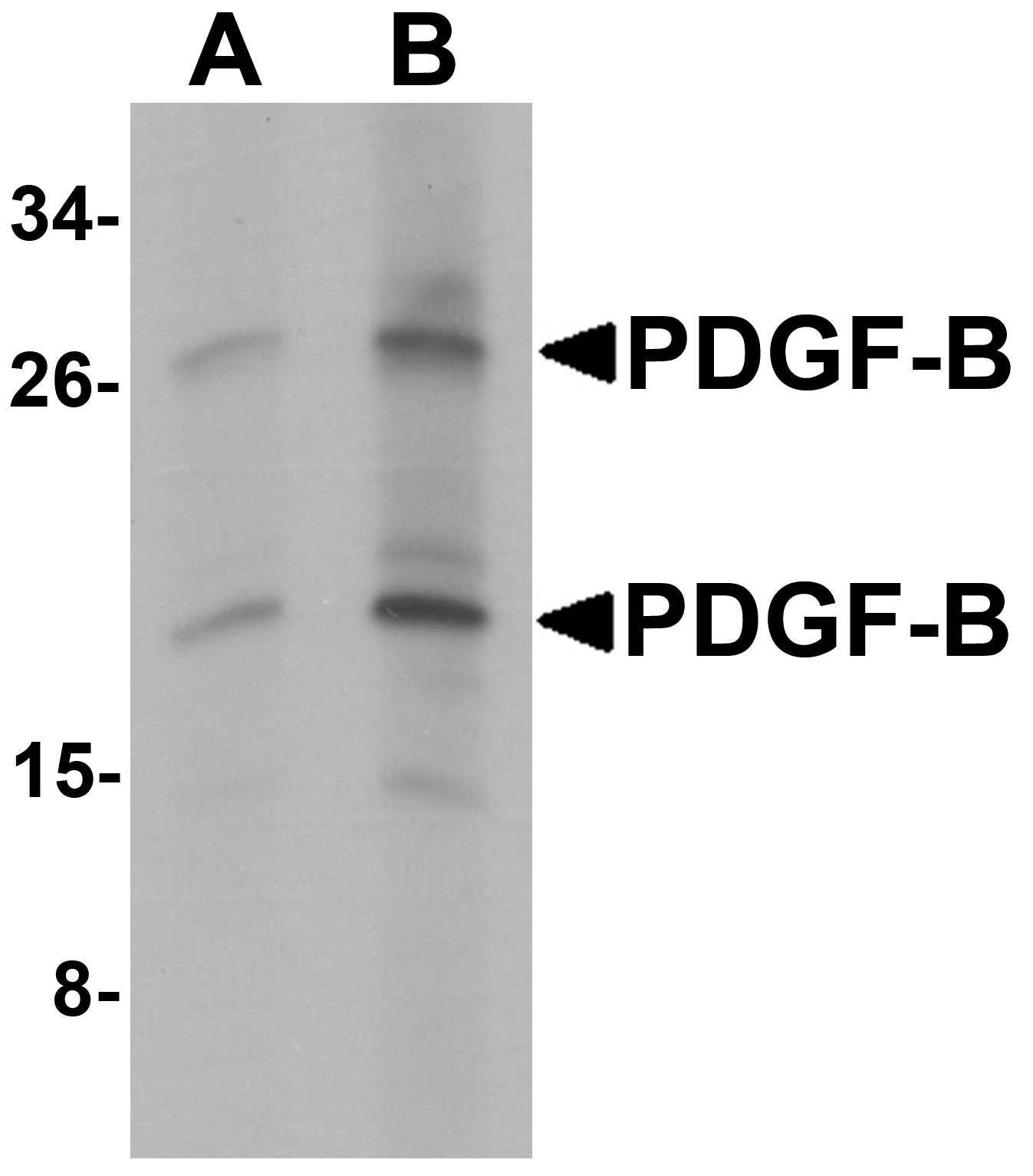 PDGF-B Antibody