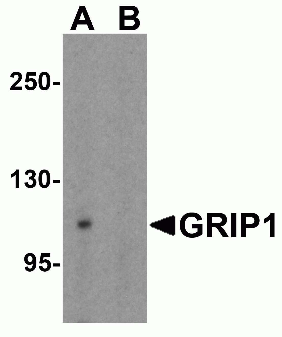 GRIP1 Antibody
