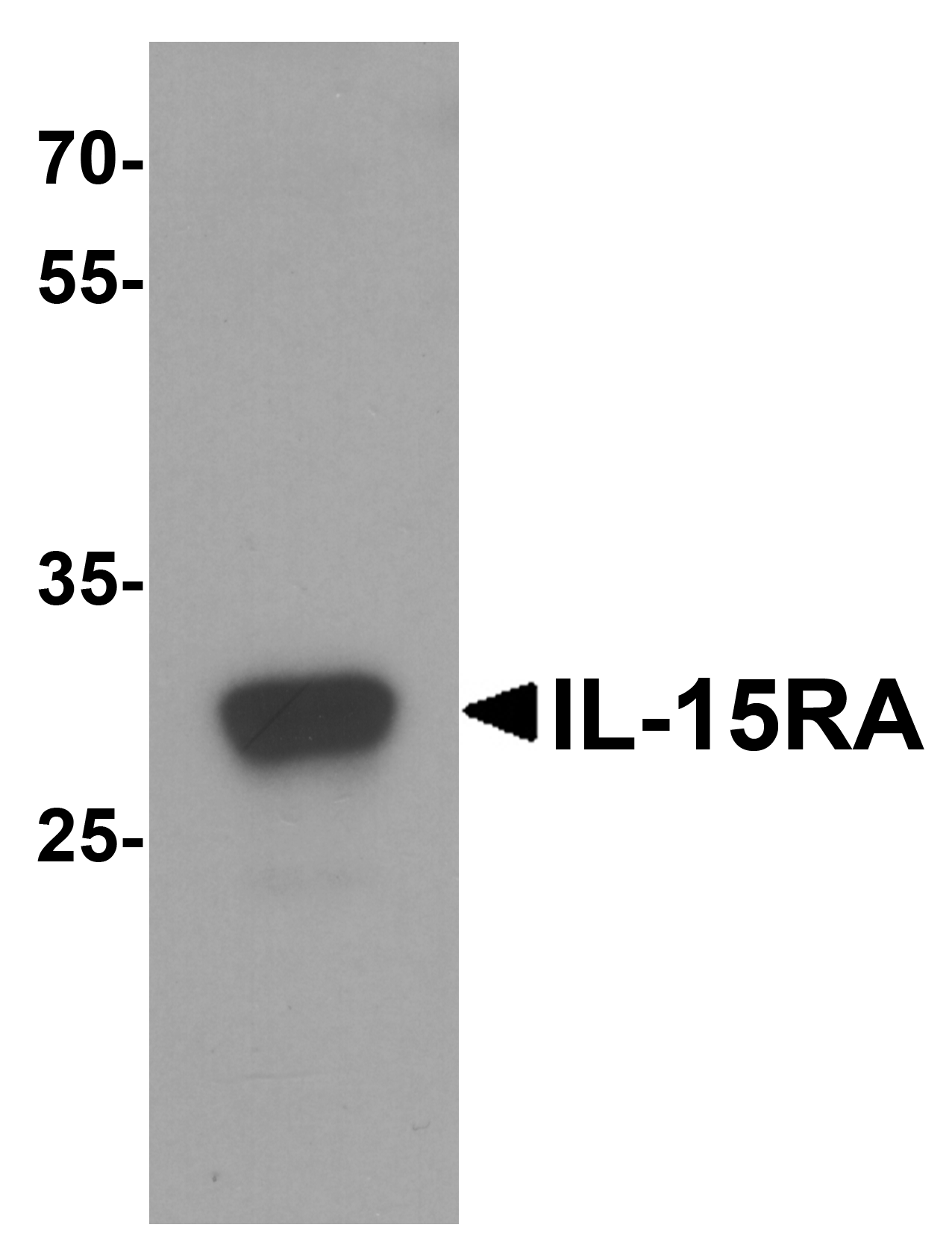 IL-15RA Antibody