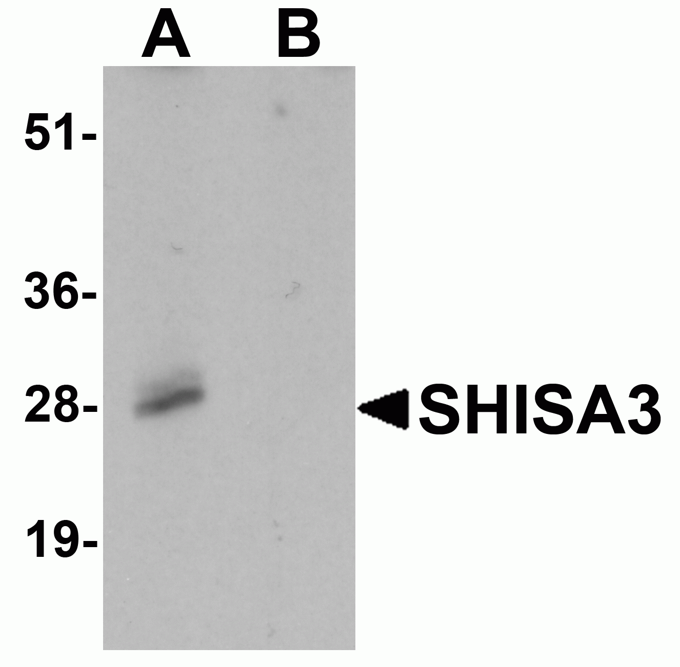 SHISA3 Antibody