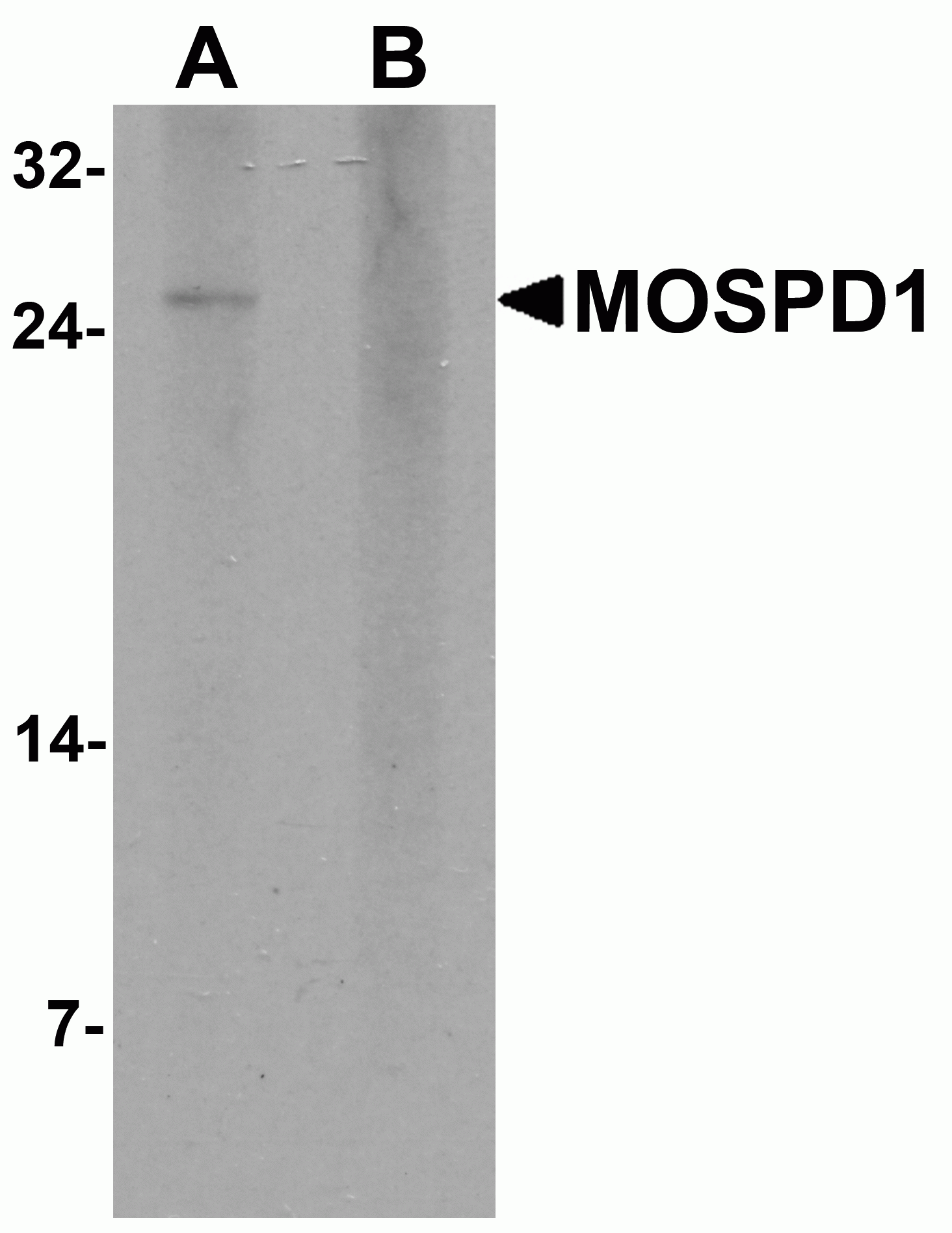 MOSPD1 Antibody