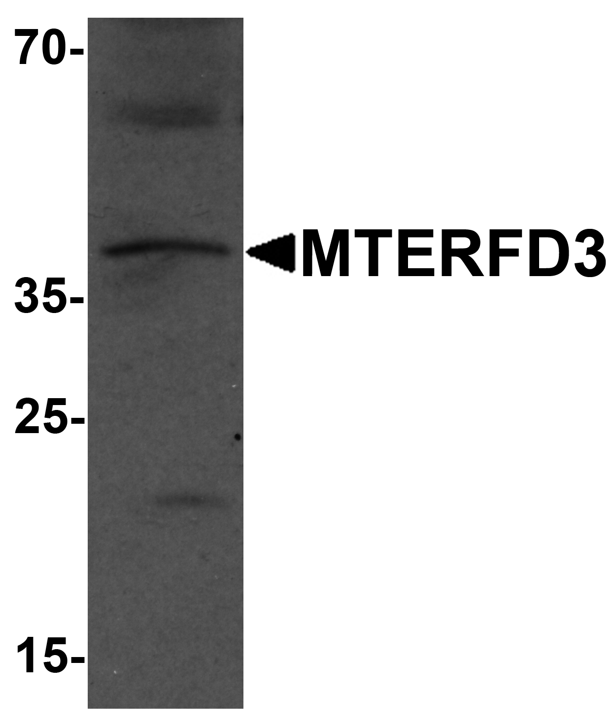 MTERFD3 Antibody