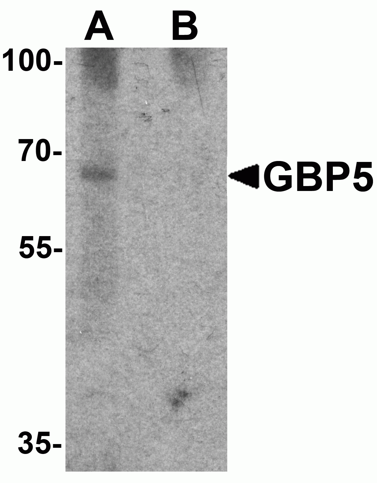 GBP5 Antibody
