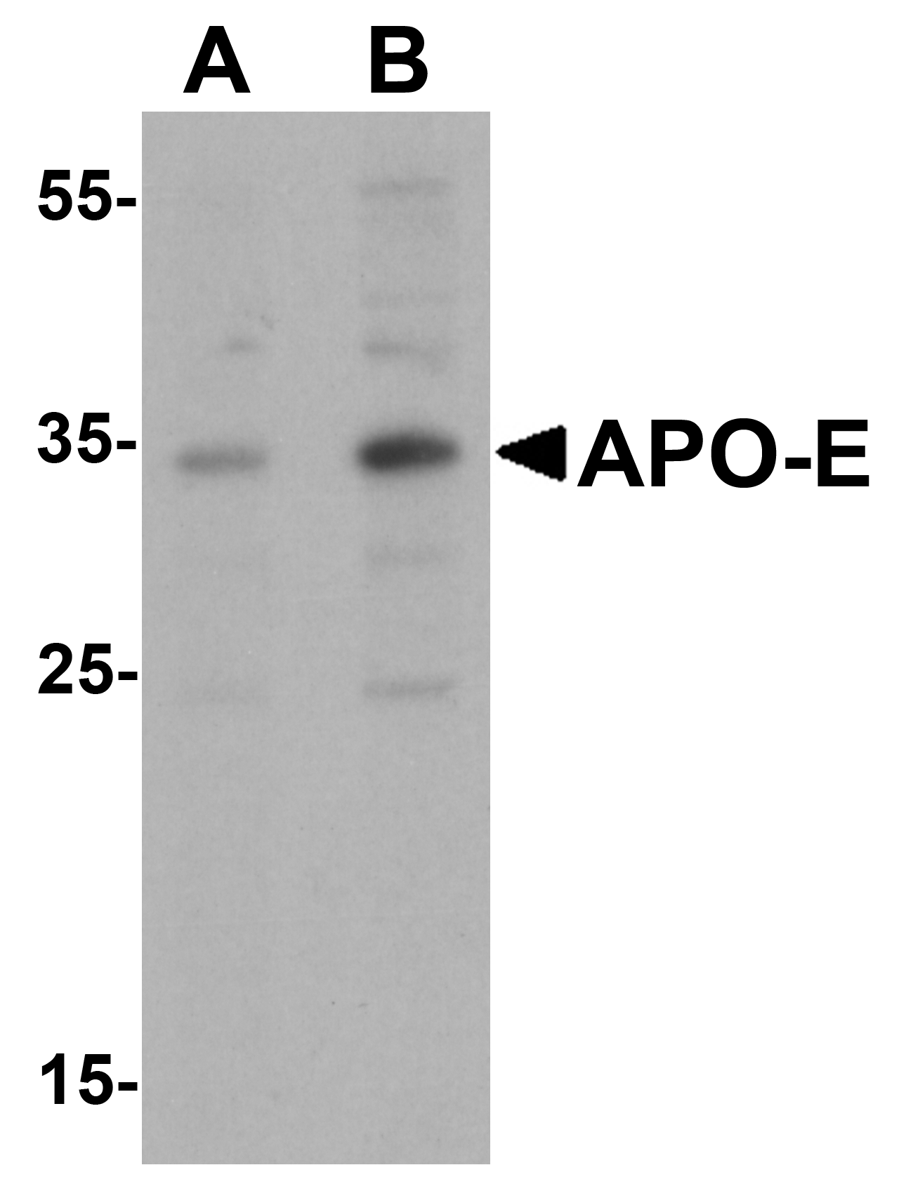 APO-E Antibody