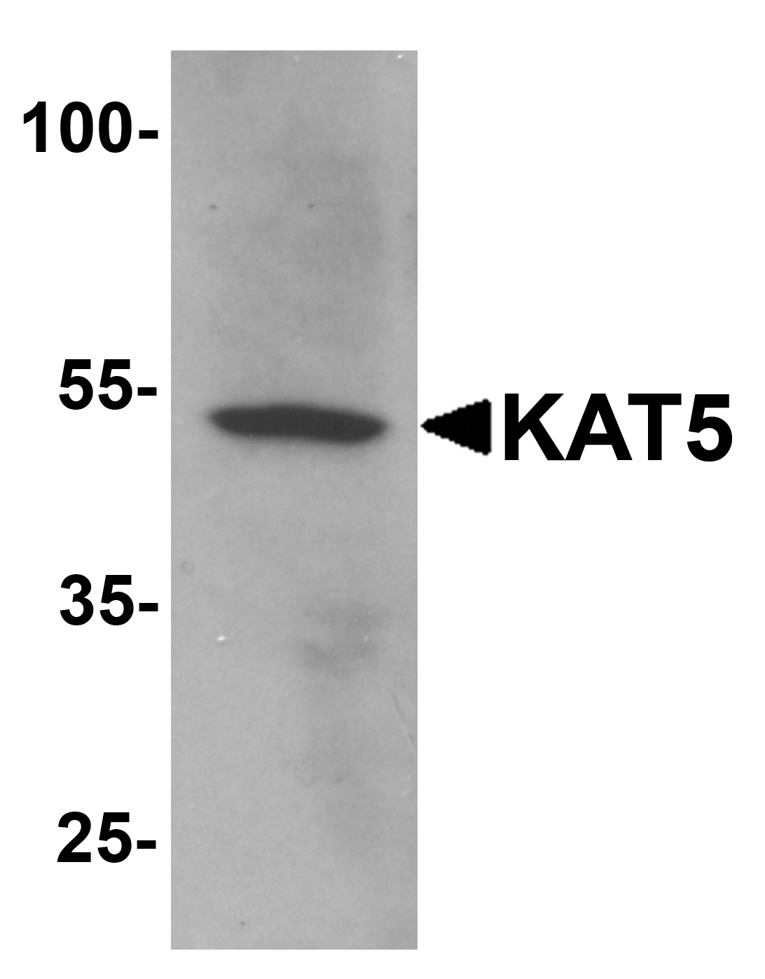 KAT5 Antibody