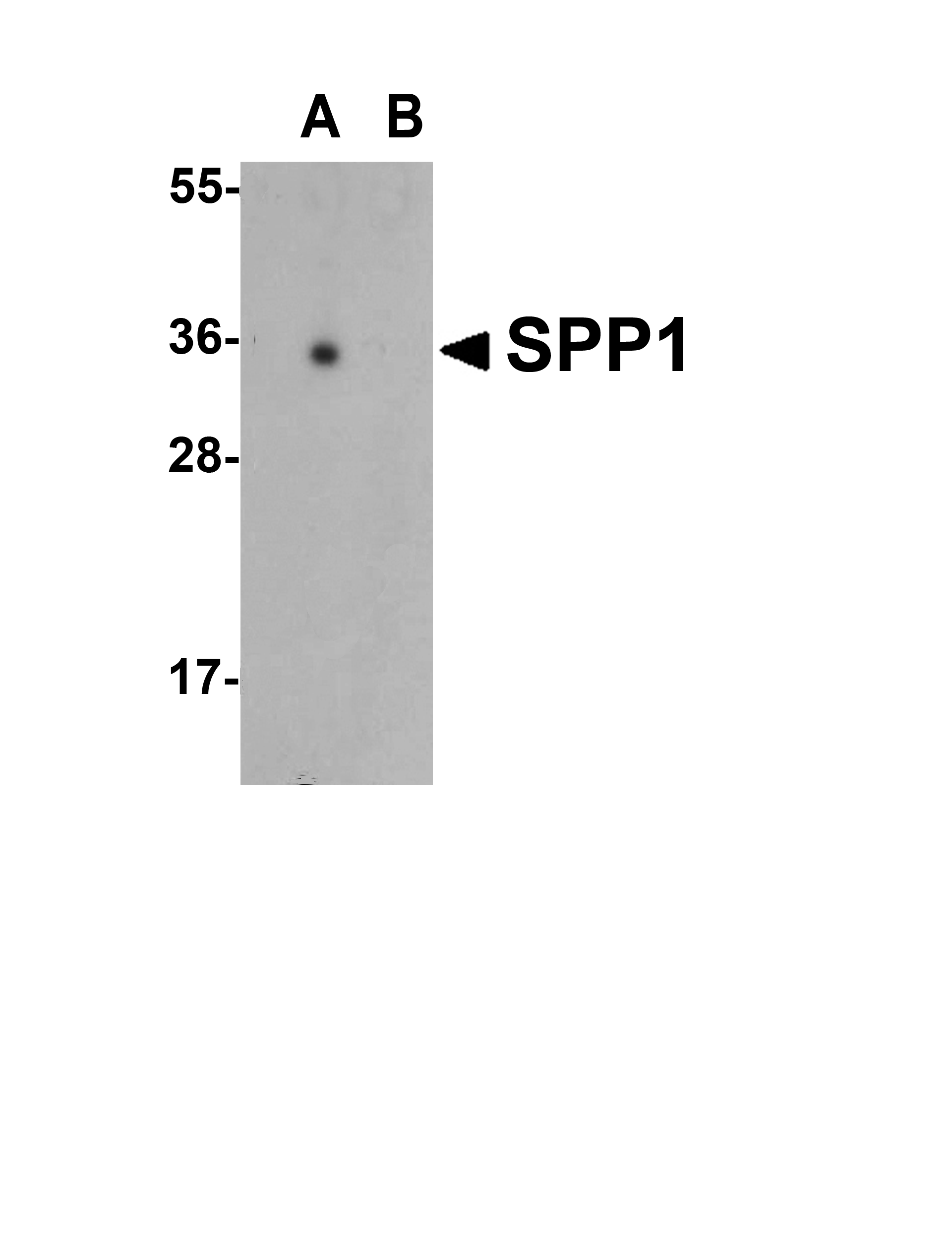 SPP1 Antibody