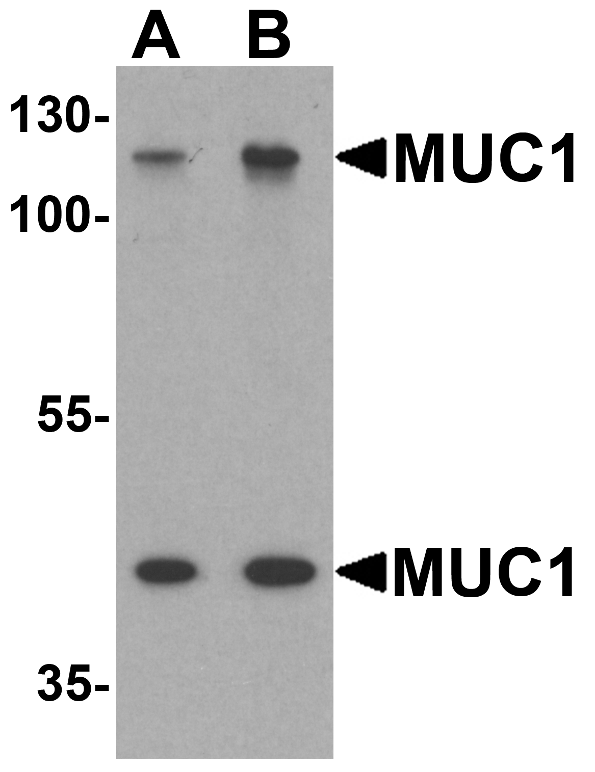 MUC1 Antibody