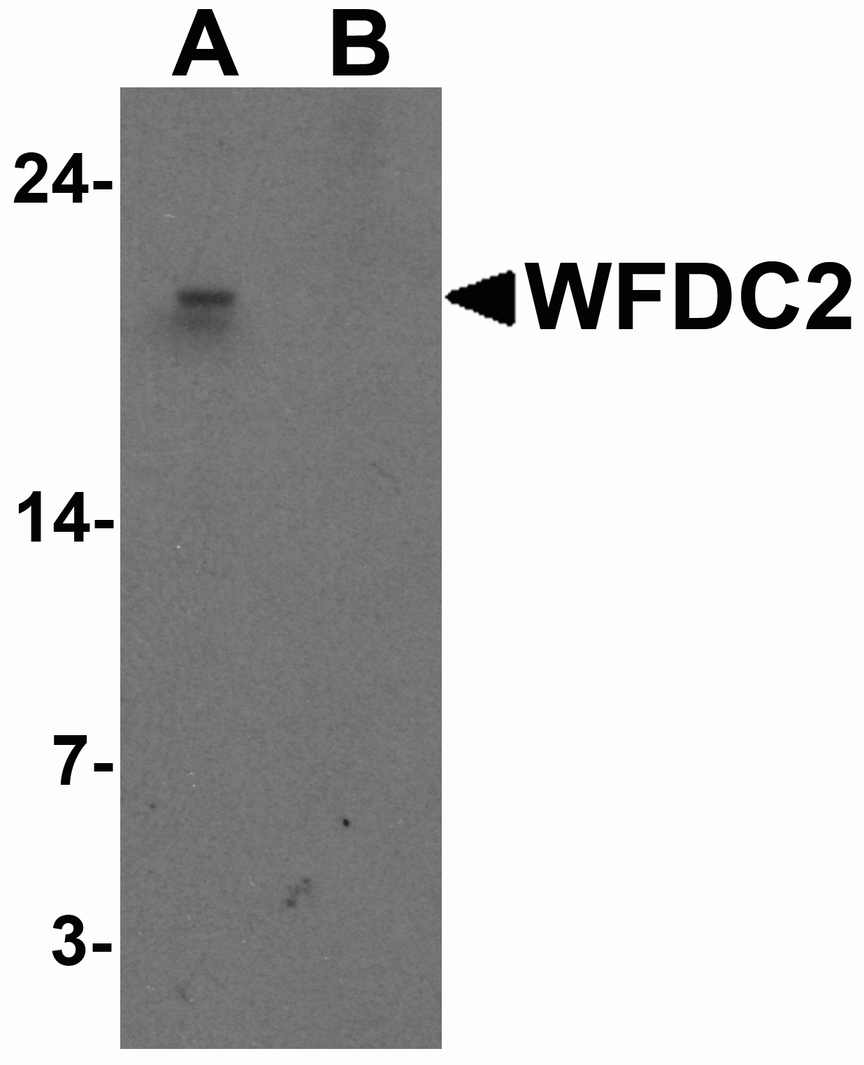 WFDC2 Antibody