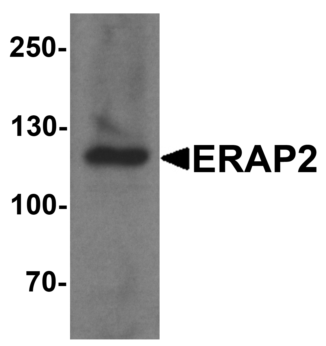 ERAP2 Antibody