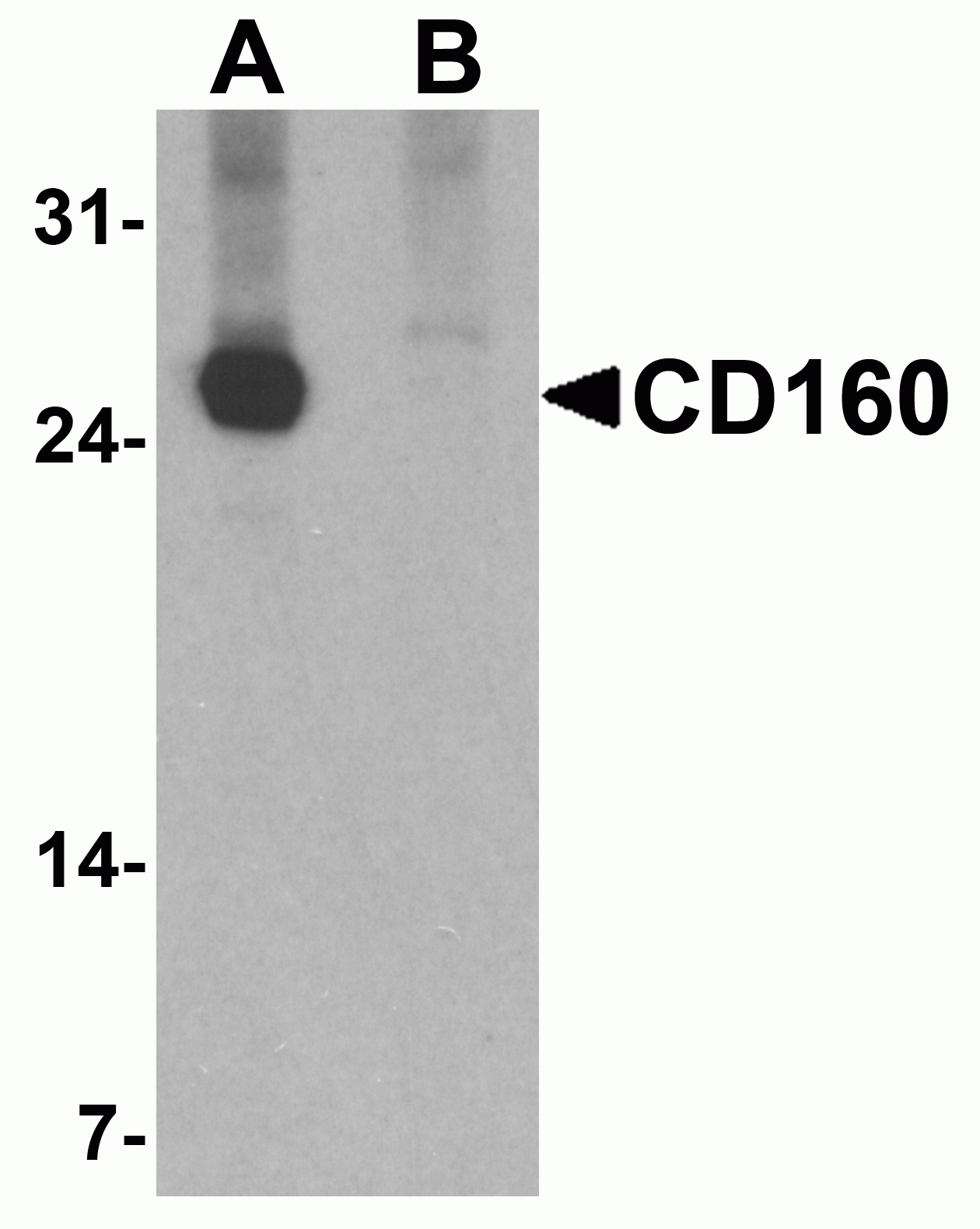 CD160 Antibody