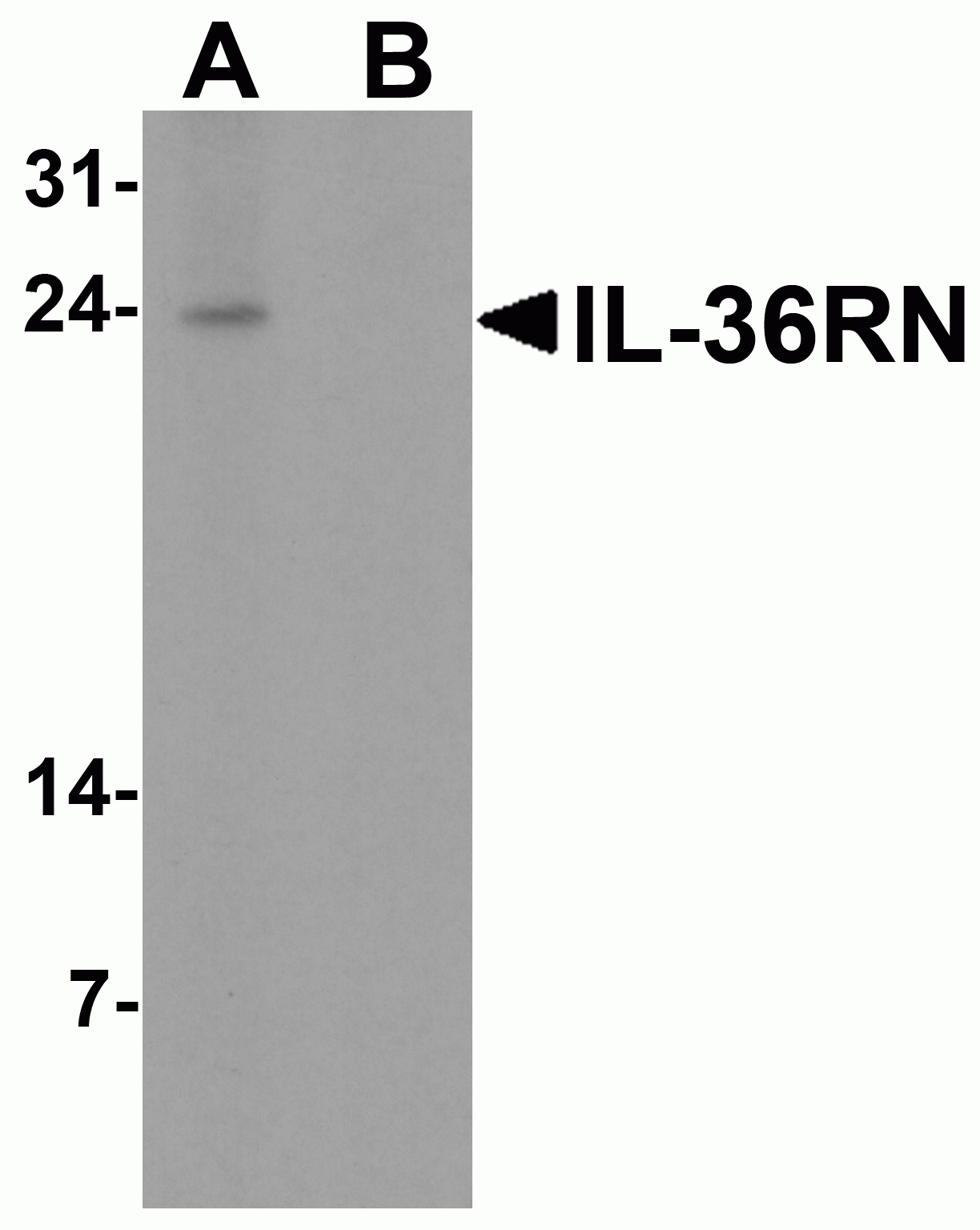 IL-36RN Antibody