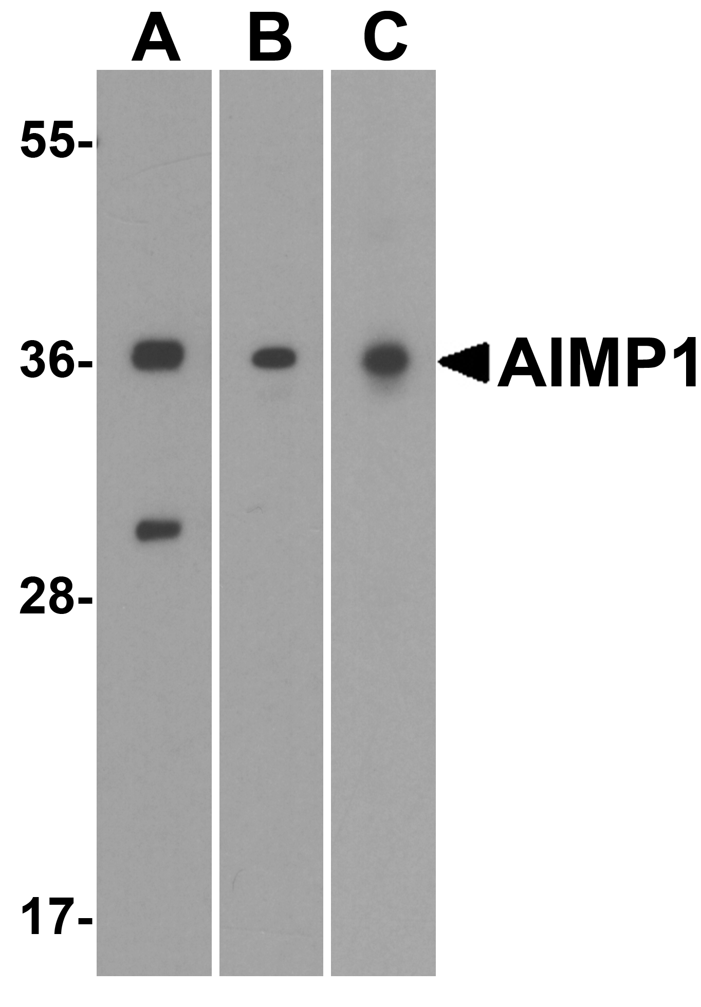 AIMP1 Antibody