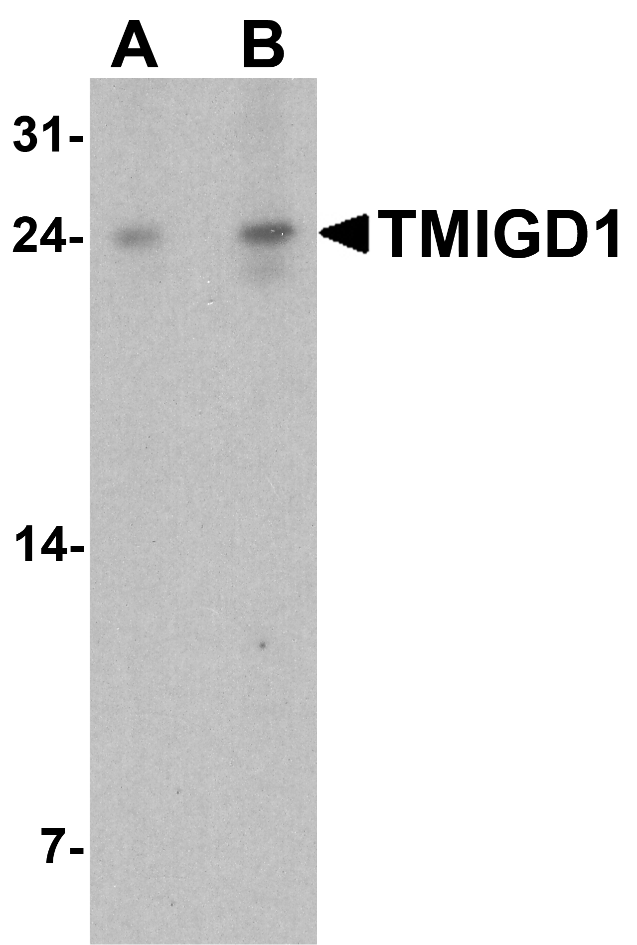 TMIGD1 Antibody