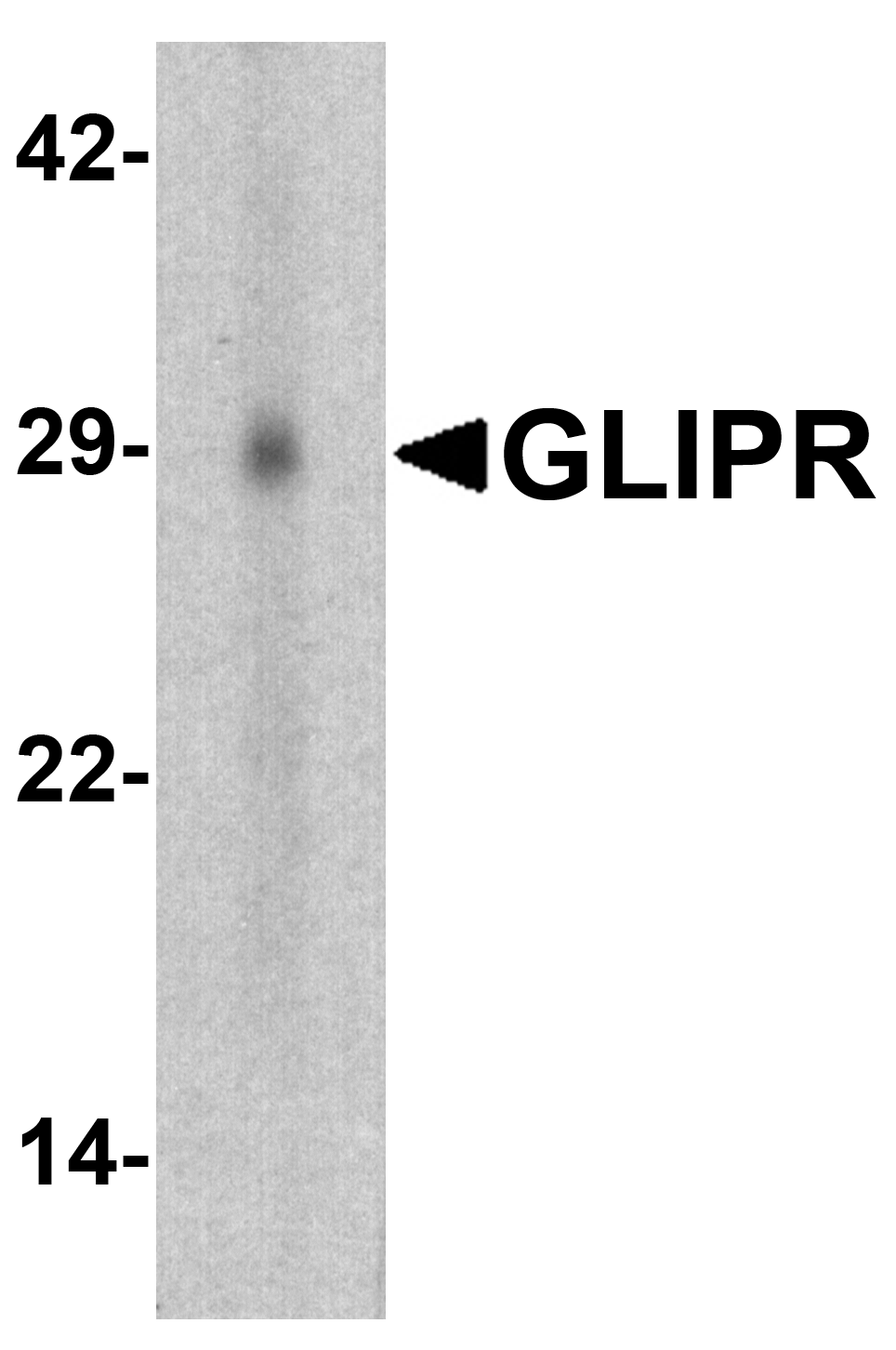 GLIPR1 Antibody