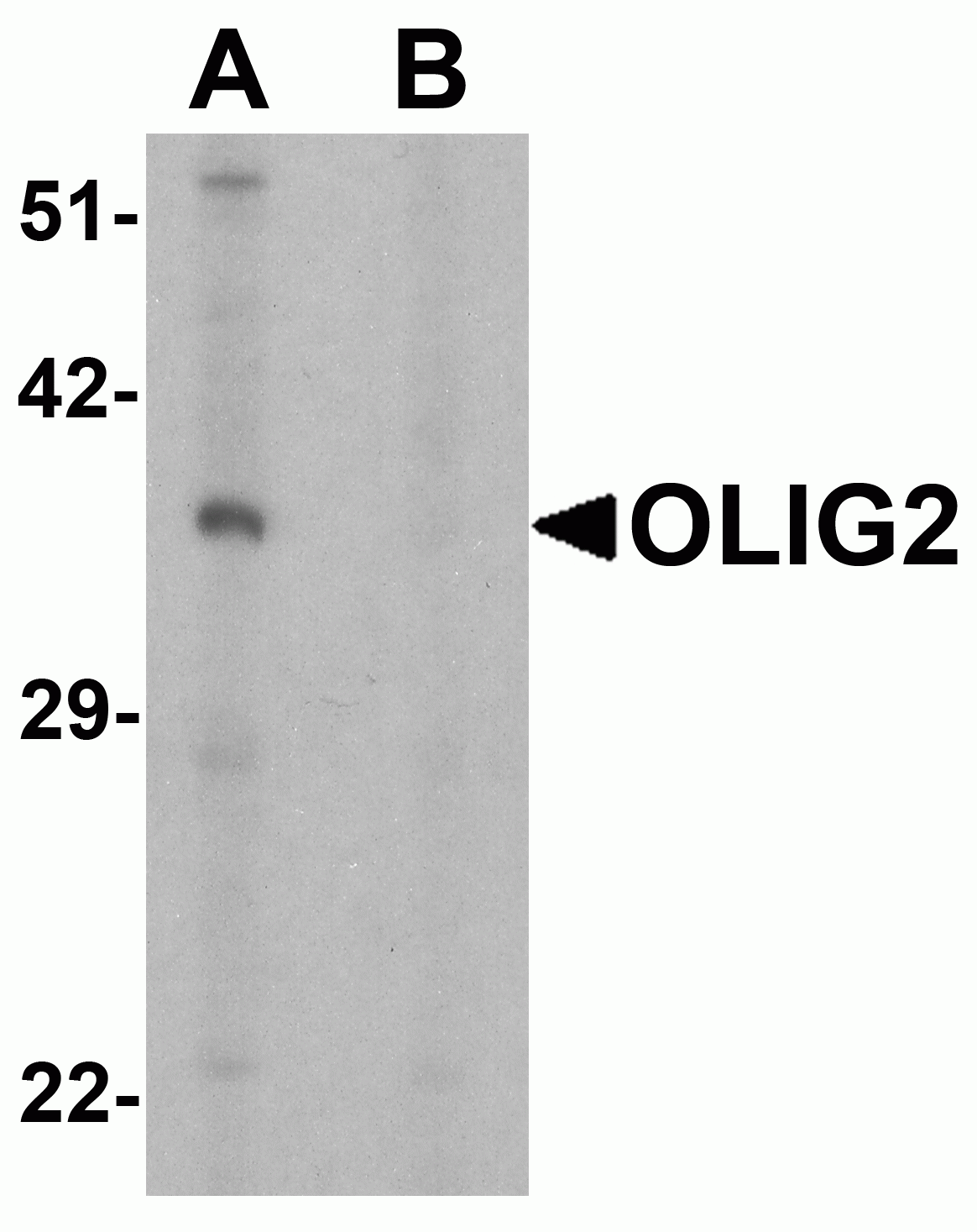 OLIG2 Antibody