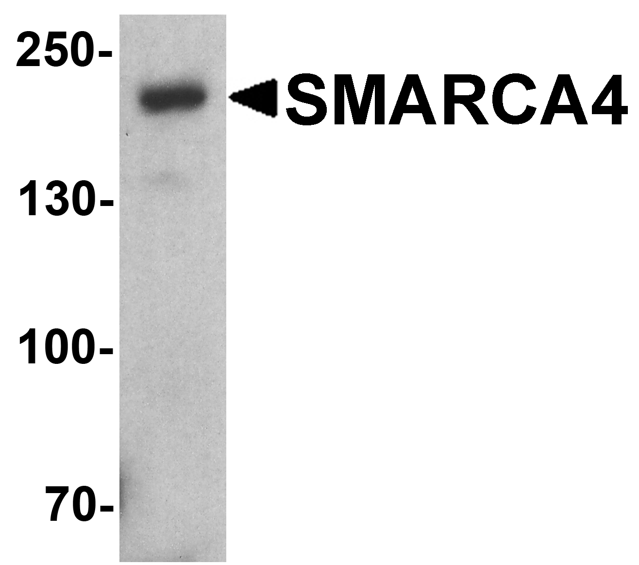 SMARCA4 Antibody