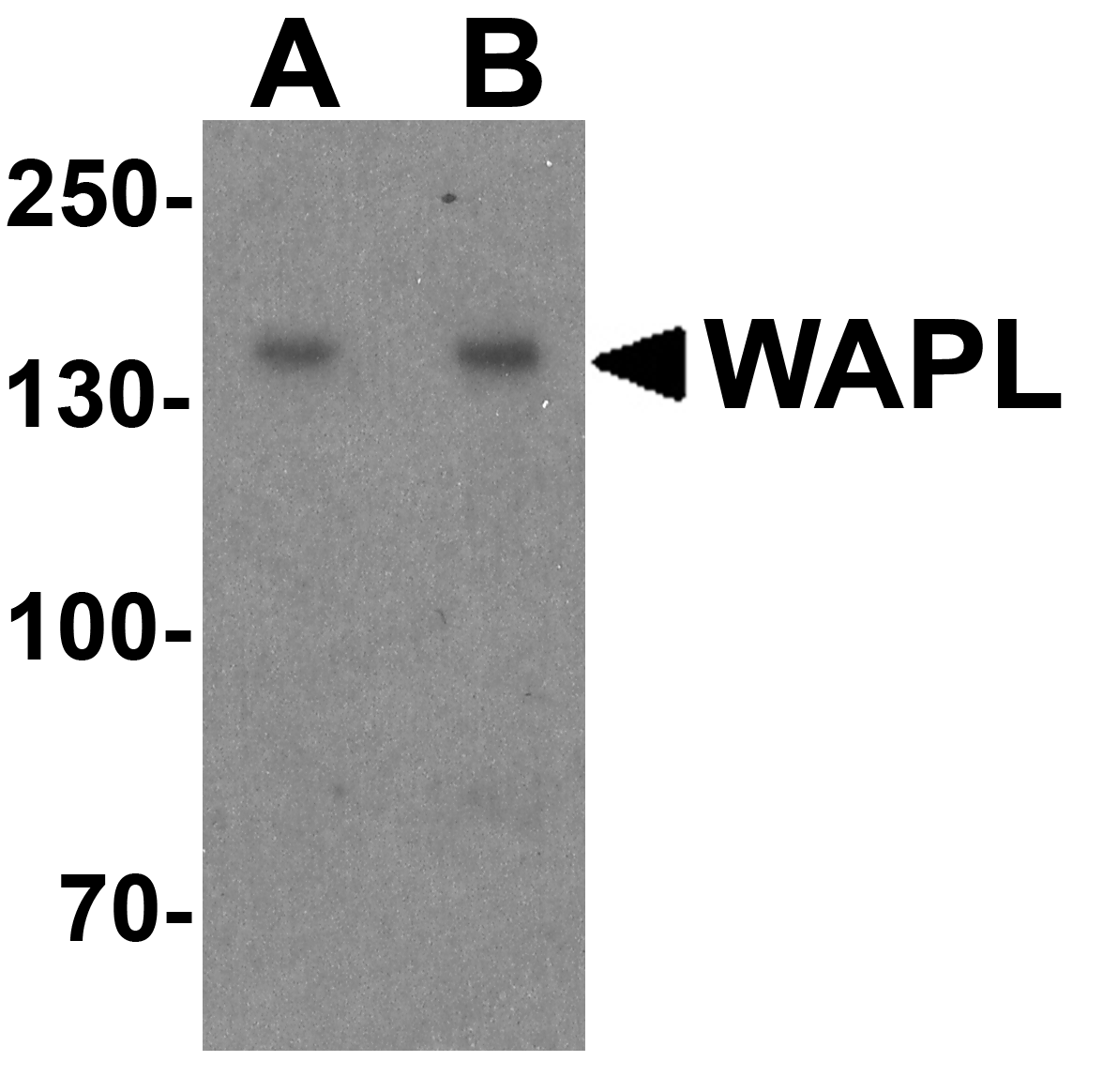 WAPL Antibody
