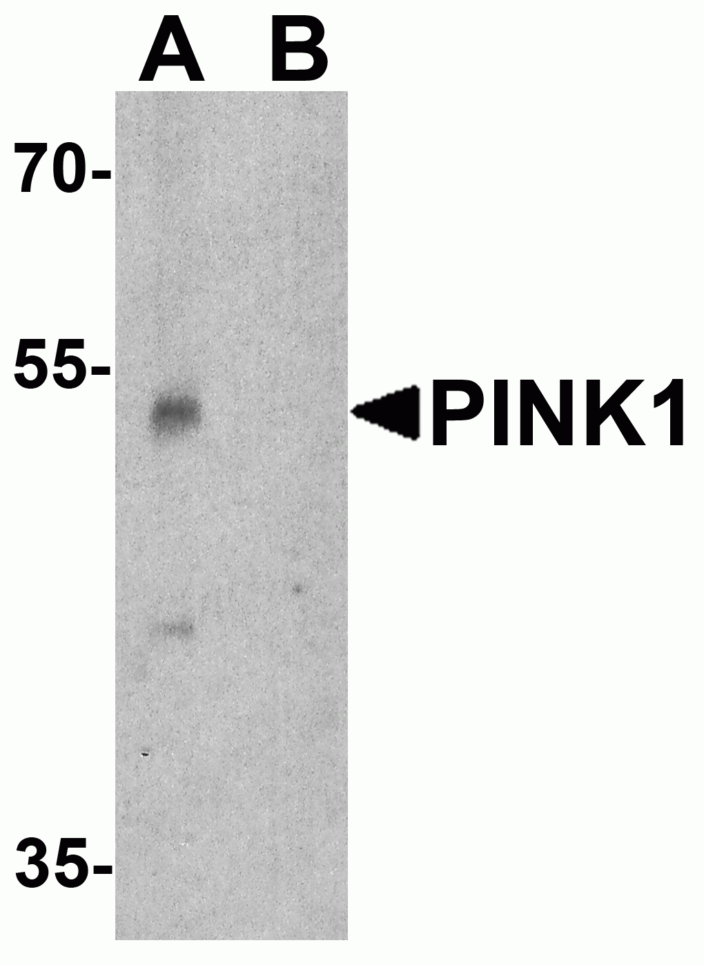 PINK1 Antibody