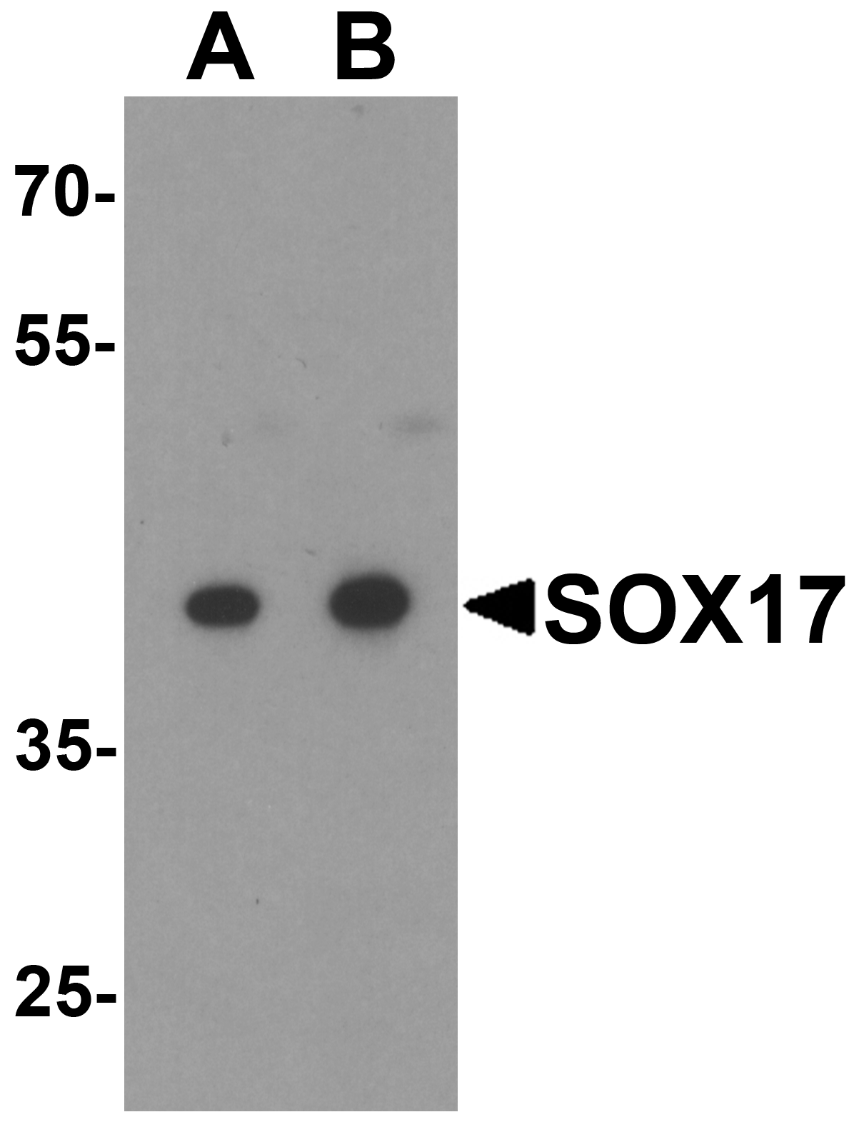 SOX17 Antibody