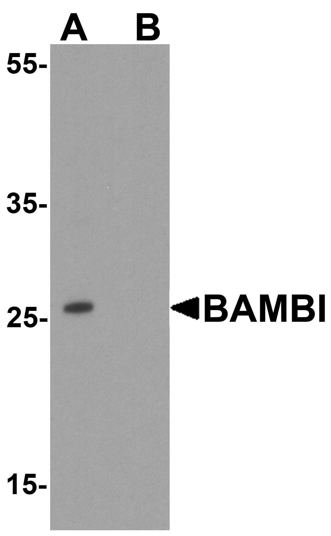 BAMBI Antibody