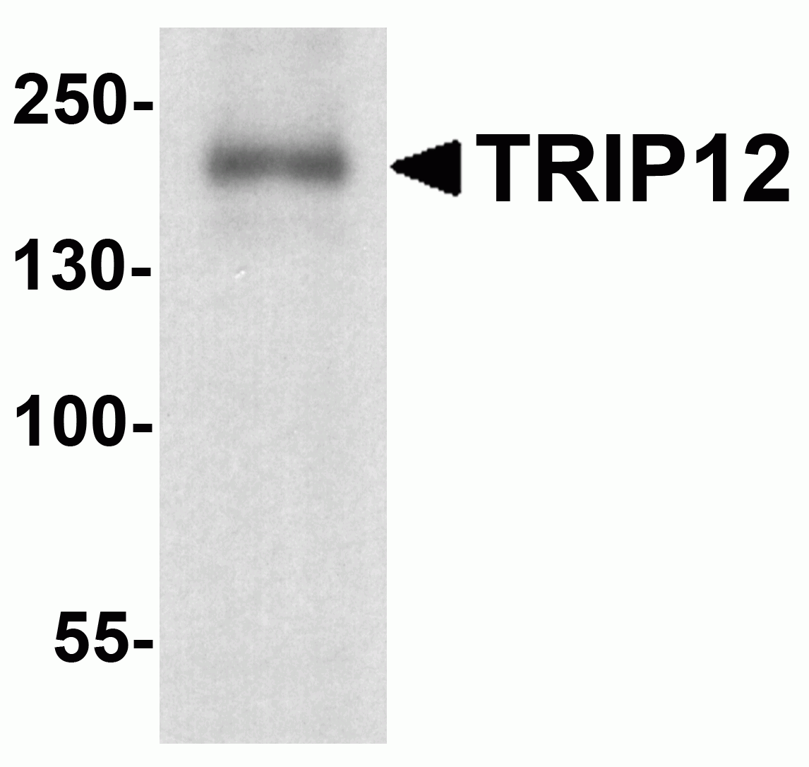 TRIP12 Antibody