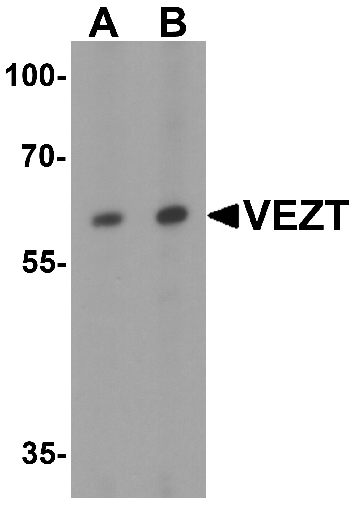 VEZT Antibody