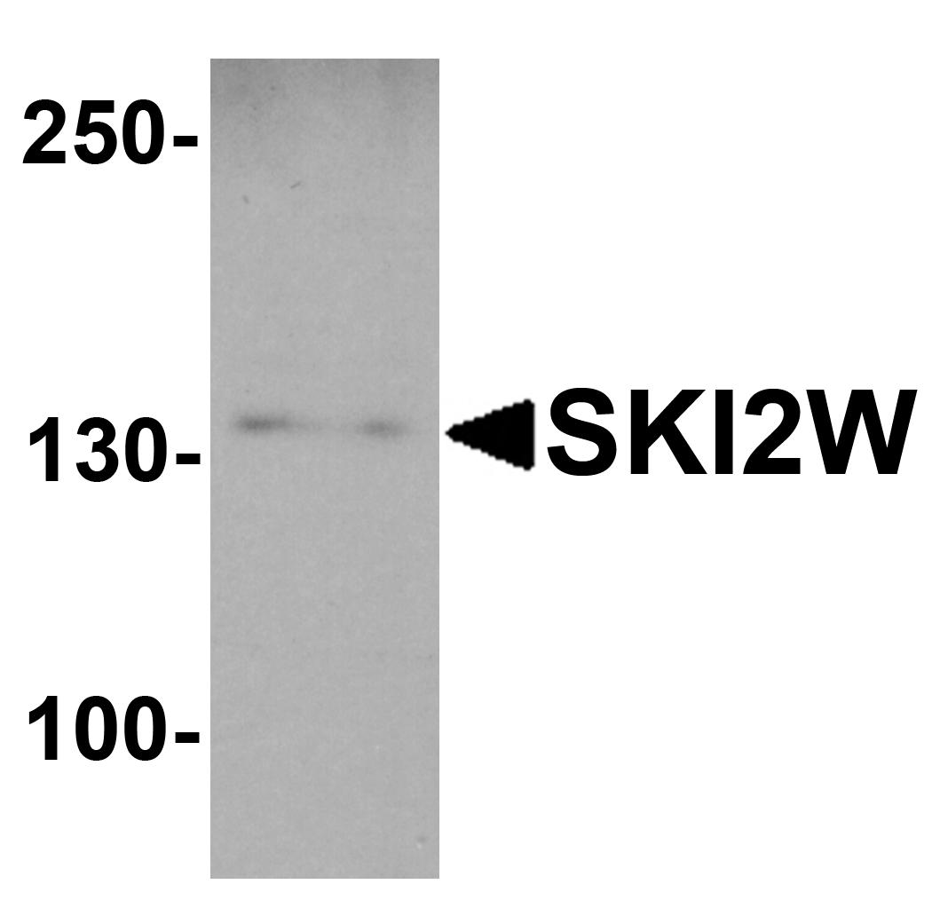 SKI2W Antibody