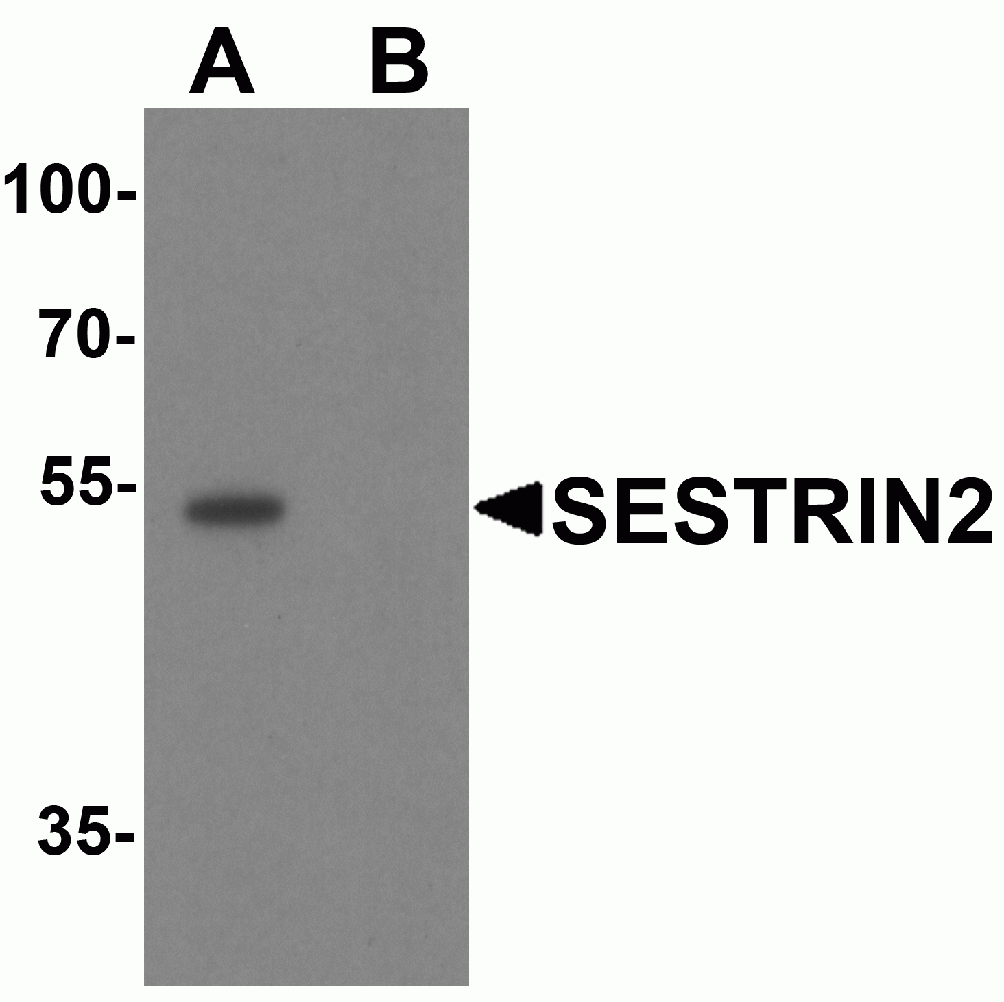 SESTRIN2 Antibody