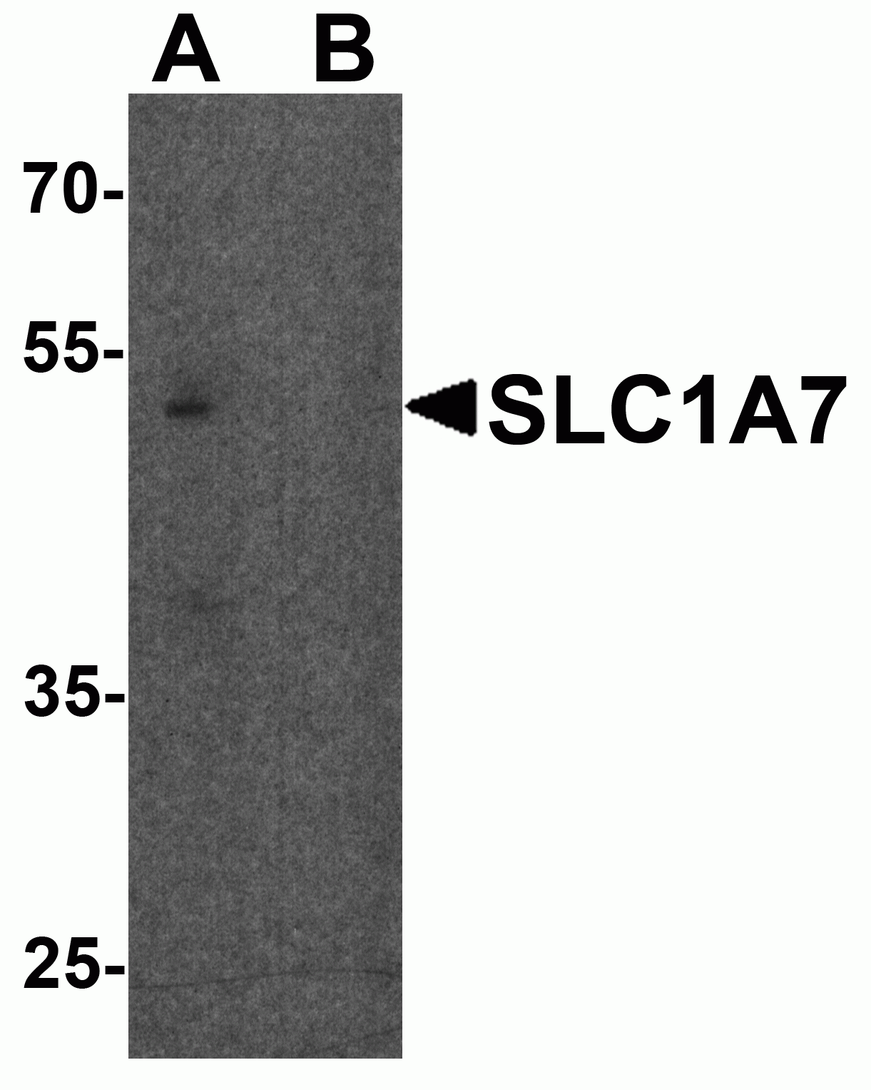 SLC1A7 Antibody