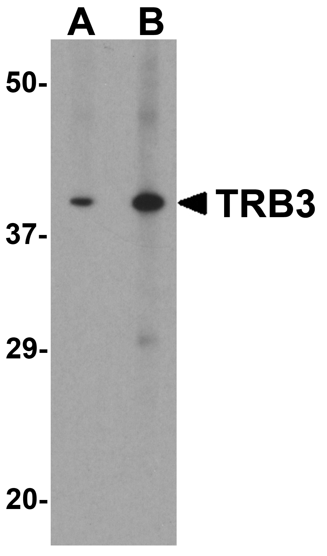 TRB3 Antibody