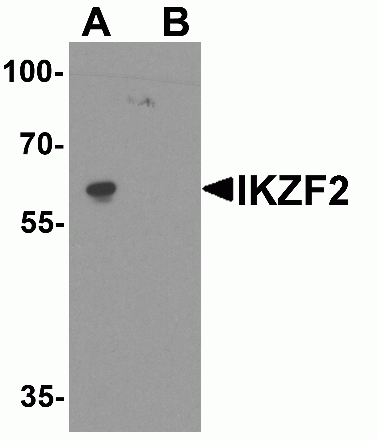 IKZF2 Antibody