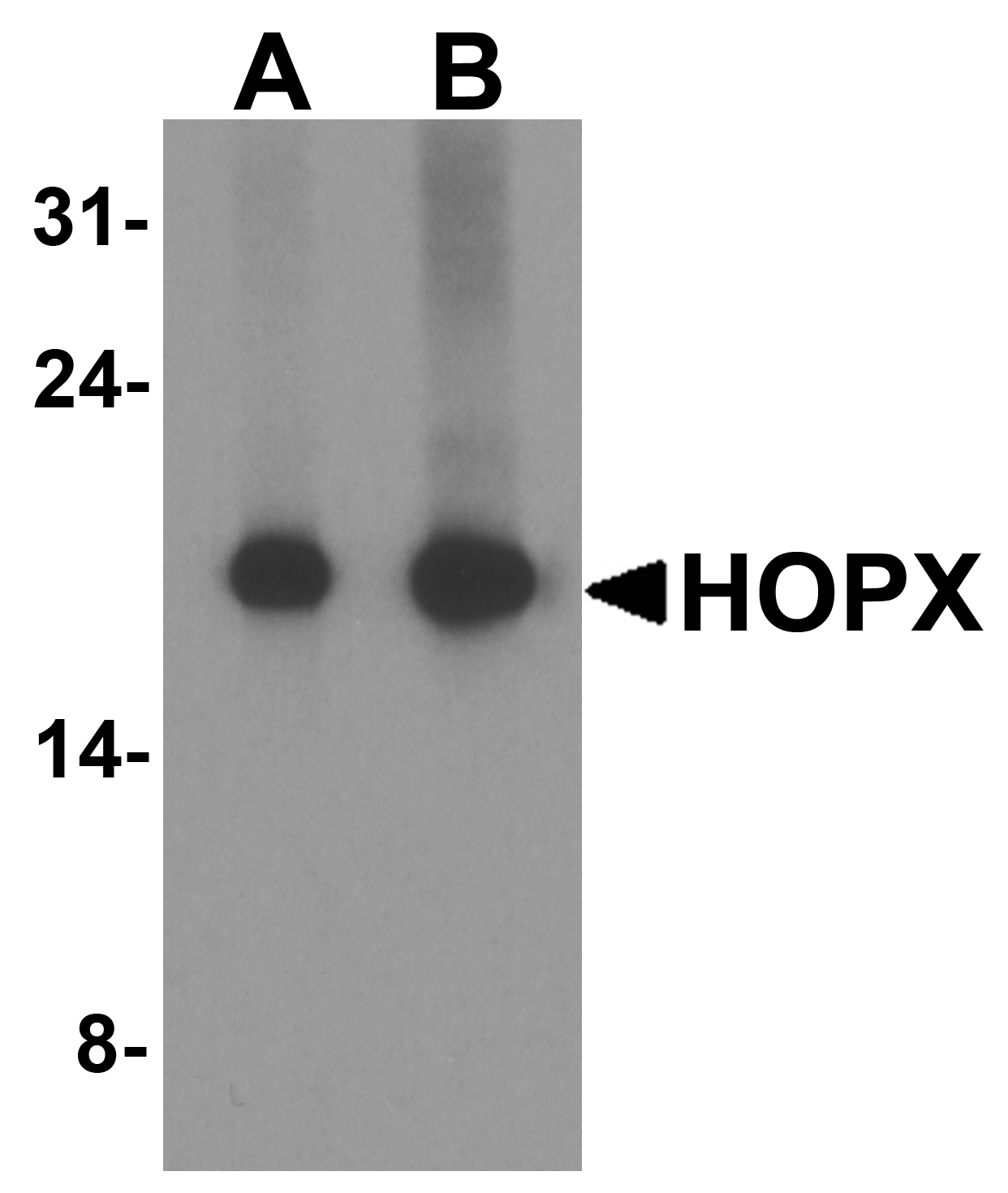 HOPX Antibody