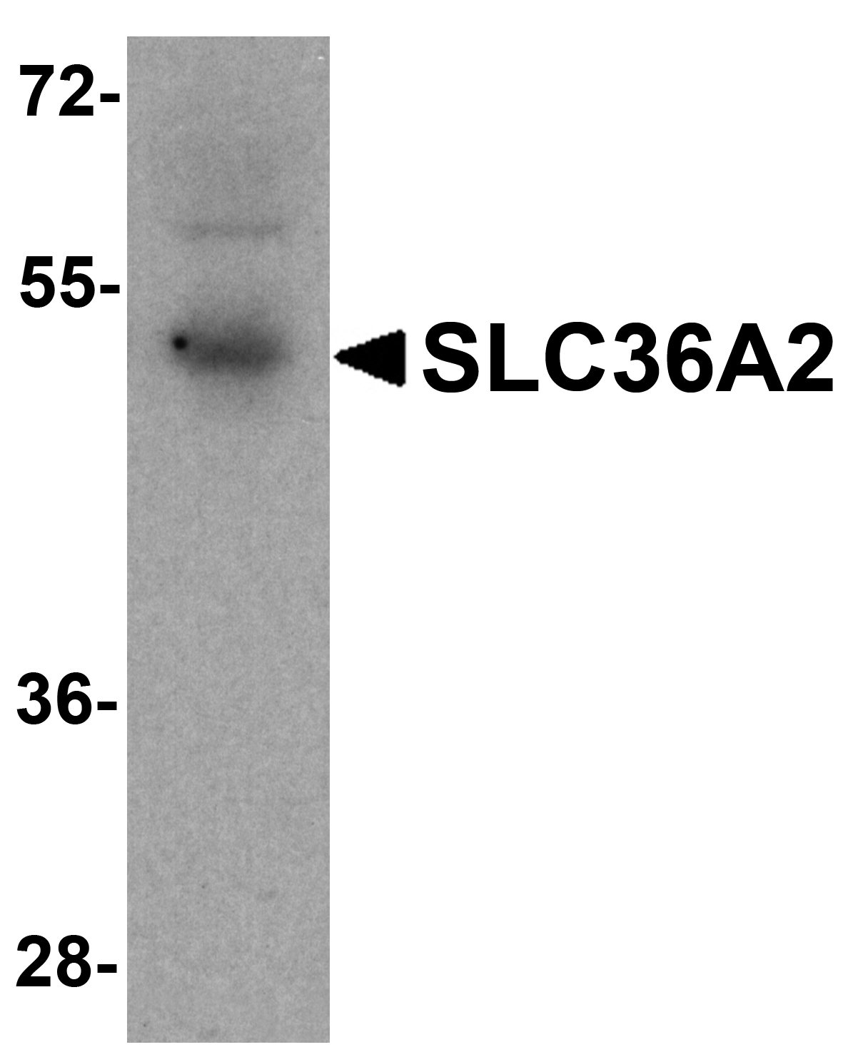 SLC36A2 Antibody