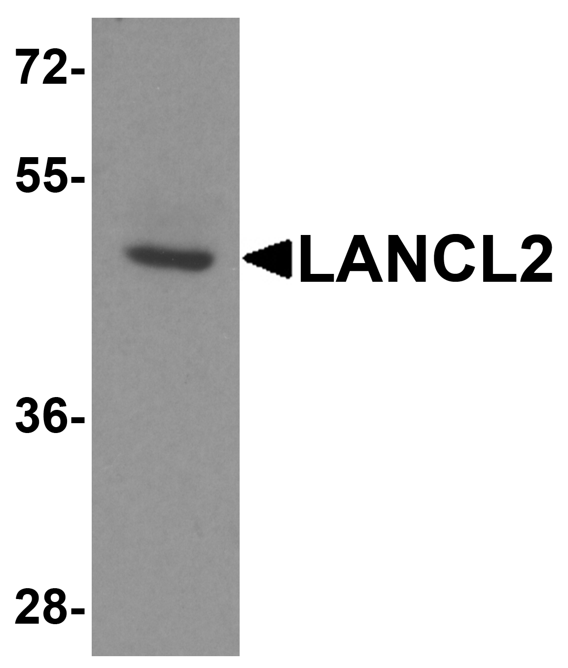 LANCL2 Antibody