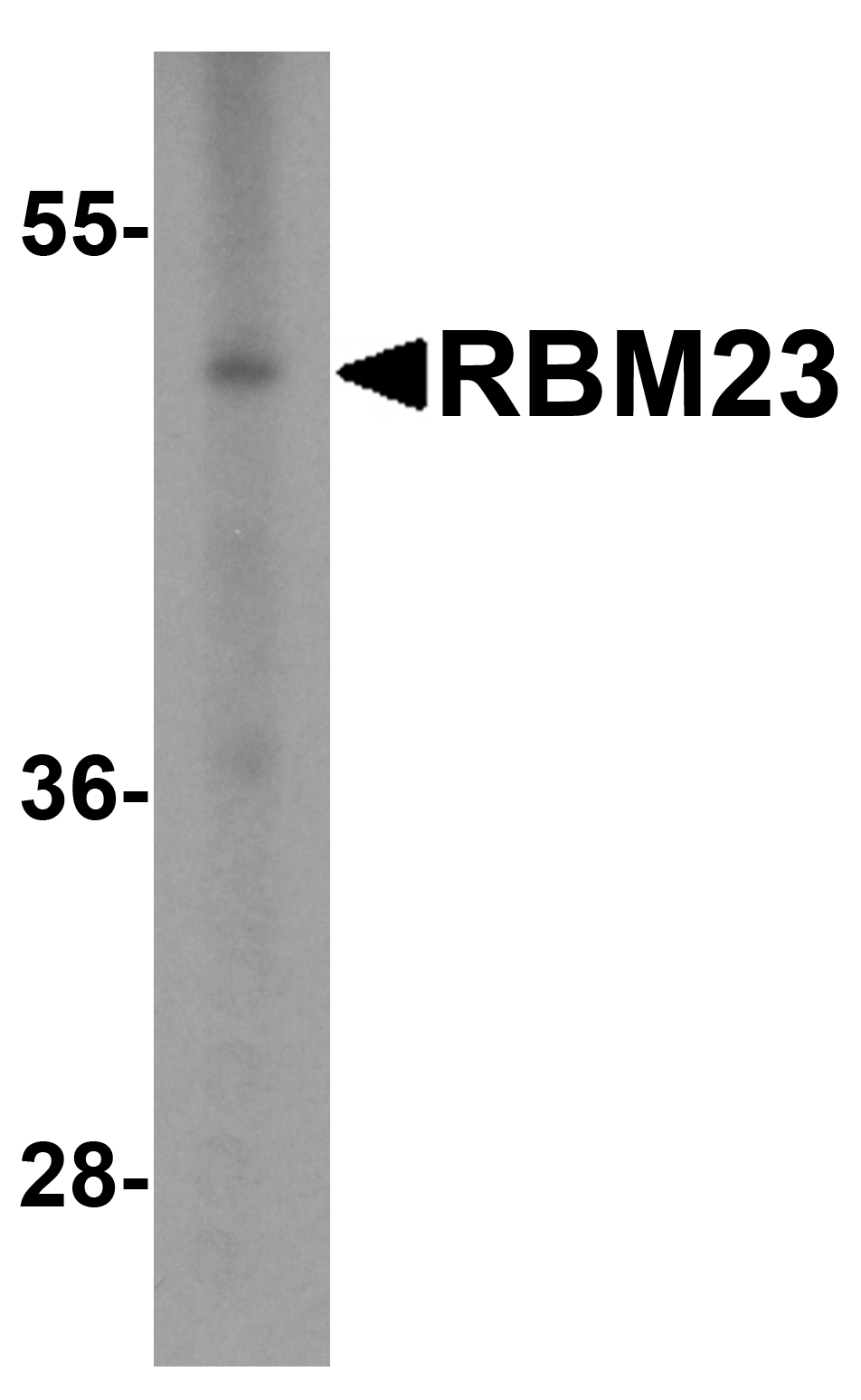 RBM23 Antibody