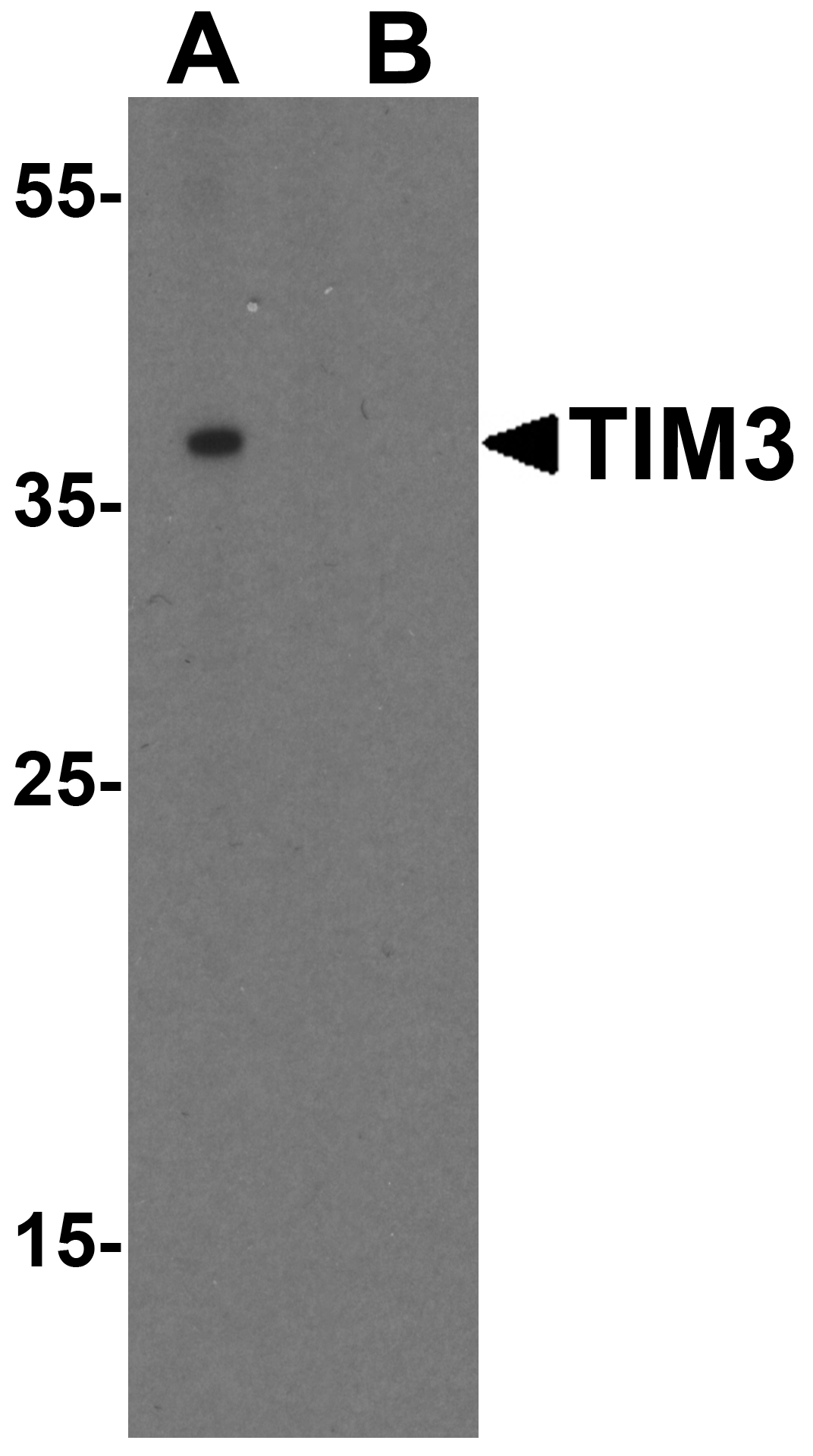 TIM-3 Antibody