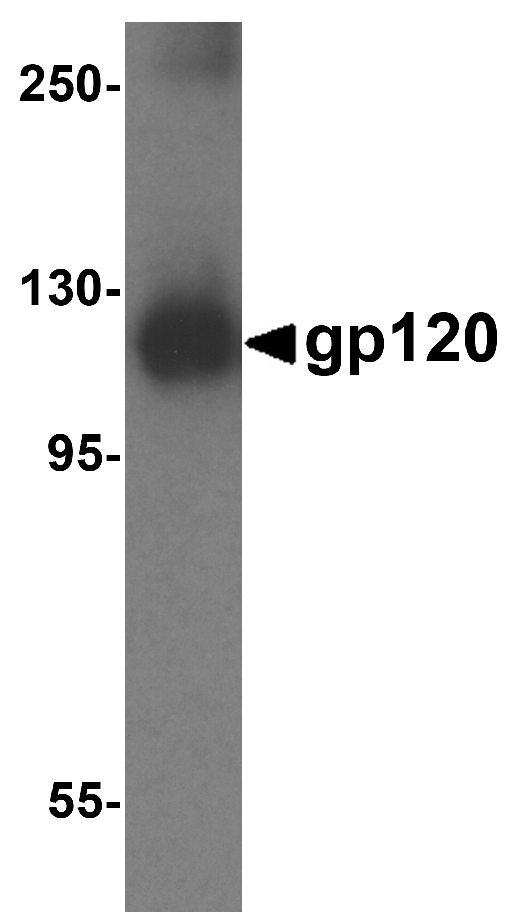 gp120 Antibody