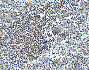 Immunohistochemical analysis of paraffin-embedded human spleen tissue using anti-CXCR4 antibody (1009) at 5 μg/ml.
