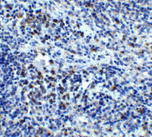 Immunohistochemical analysis of paraffin-embedded human spleen tissue using anti-CXCR4 antibody (1012) at 5 μg/ml.