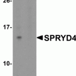 Western blot analysis of SDHAF2 in rat liver tissue lysate with SDHAF2 antibody at 1 μg/mL in (A) the absence and (B) the presence of blocking peptide.
