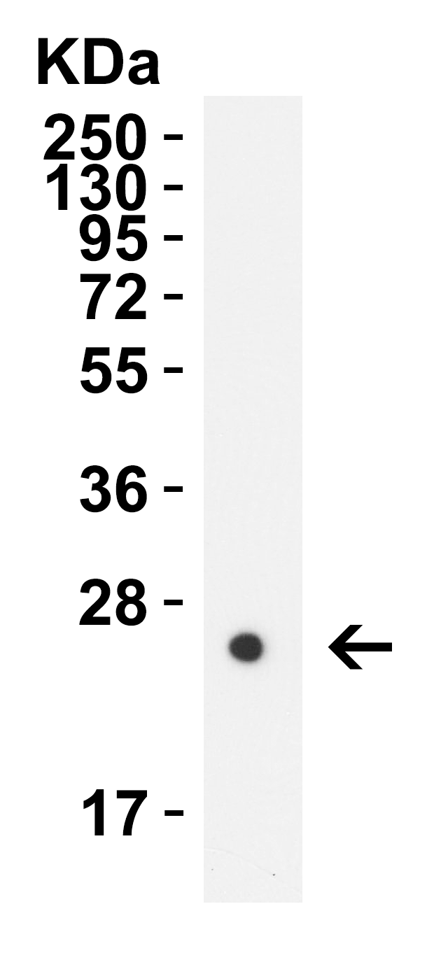 HIV-1 p24 Antibody [2F11G1]