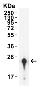 HIV-1 p24 Antibody [9D2F6]