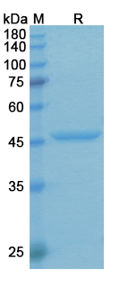Aflibercept Antibody, Monoclonal