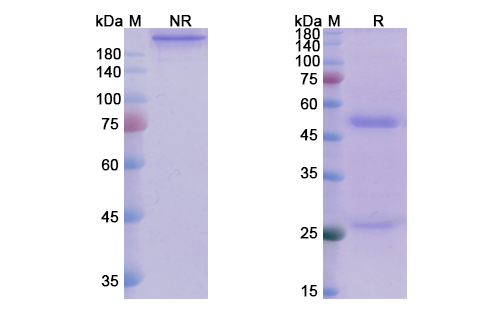 Andecaliximab (MMP9) Antibody, Monoclonal