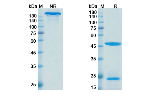 Denintuzumab Mafodotin (CD19) Antibody, Monoclonal