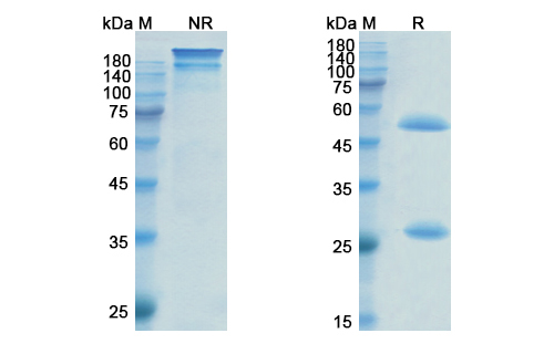 Pinatuzumab Vedotin (CD22) Antibody, Monoclonal